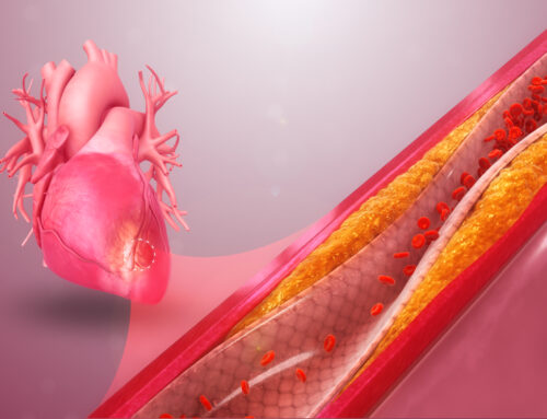 Many Young Adults Have High Long-term Risk for Cardiovascular Disease, Study Finds